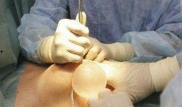 补牙全过程爆料视频播放,从检查到恢复，一视频看尽牙齿修复全流程