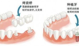 补牙全过程爆料视频播放,从检查到恢复，一视频看尽牙齿修复全流程