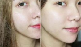 美容院祛斑爆料视频,真实效果与潜在风险大曝光